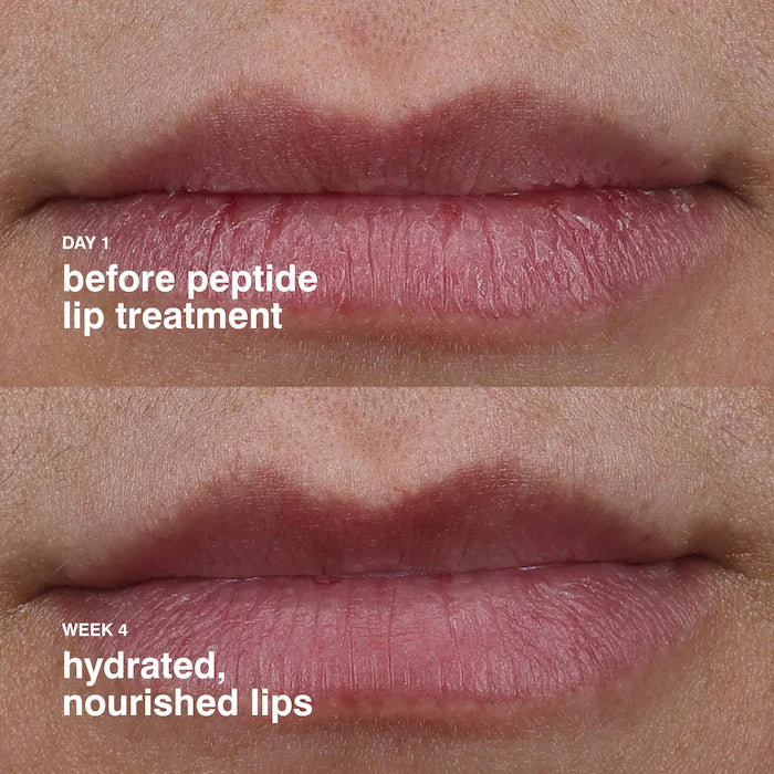Labial Rhode Peptide Lip Treatment - Strawberry Glaze